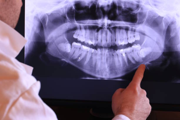 Best Emergency Tooth Extraction in Mccook, NE